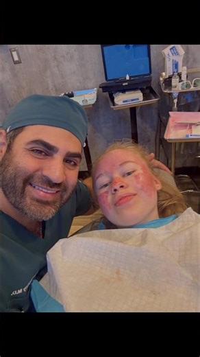 Acne scar laser treatment with Dr. Hazany 🤩🙌 ‪@scarhealinginstitute‬ ‪@SalarHazany‬ #starlettenation