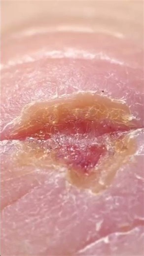 CROCODILE OIL for Skin, Pain & Health | Ancient Healing Secrets Revealed#crocodileoil #skincare