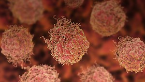 Guideline recommendations for first-line treatment intensification with PARP inhibitor combinations in patients with metastatic castration-resistant prostate cancer