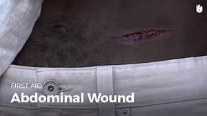 First Aid: Abdominal Wound - Learn how to save a life | Sikana