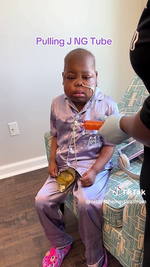 Understanding G-Tube Placement and Acid Reflux