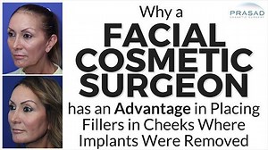Surgeons Have an Advantage in Replacing Removed Cheek Implants with Cheek Fillers