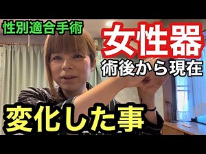 【性転換】男から女へ女性化するべく受けた性別適合手術から時間の経過とともに変化する女性器について、良くも悪くも変わった事を話します。