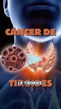 ⚠️ Thyroid Cancer | Symptoms, Cause and Treatment