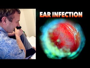 INSIDE An EAR INFECTION | Dr. Paul