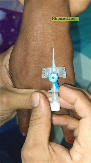 Cannula Insertion Technique 💉 | Easy IV Cannulation #Shorts #