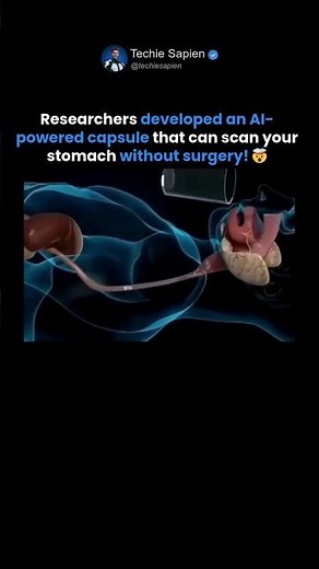 Researchers Develop AI Capsule That Scans Your Stomach Without Surgery! 🤯