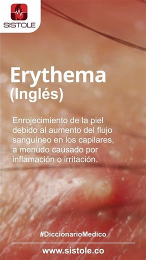 Diccionario Medico #64 ​📘📖​🧑‍⚕️​👩‍⚕️⚕️🧠🫀​🫁​👁️​🦴​ ​| Sistole