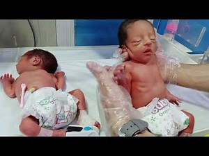 Feeding Time for Preterm Twins 👶👶 | NICU Care Moments#newbornbaby