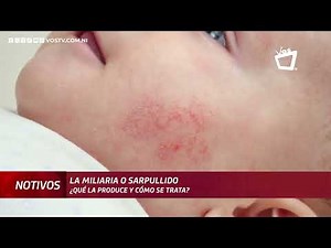 Sarpullido ¿qué lo produce y cómo se trata?