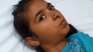 Sindrom extra-piramidal acut in contextul unei administrari de metoclopramid, in doza corecta. Această prezentare de caz NU este decat o pledoarie pentru UTILIZAREA RAȚIONALA a metoclopramidului in situatiile in care beneficiile depăşesc riscul estimat la fiecare caz in parte. Nu doresc că induc teamă sau incertitudini față de efecte ale metoclopramidului in general. Şi in final trebuie spus că dacă ați folosit metoclopramid în trecut fară efecte adverse nu există risc semnificativ de efecte adv