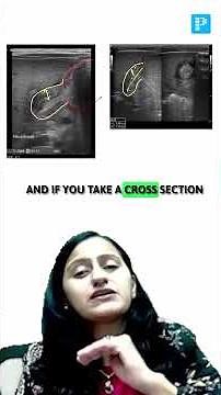 Radiology LRR for INI-CET 2026 | Quick Revision by Dr. Nikita #radiology