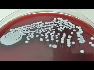 Staphylococcus epidermidis Colony morphology on Blood agar