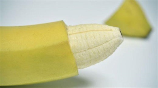 Dokter, Usia Berapa Paling Dianjurkan Khitan Menurut Medis? - TribunHealth.com