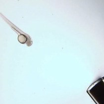 Video: Using Light Sheet Fluorescence Microscopy to Image Zebrafish Eye Development