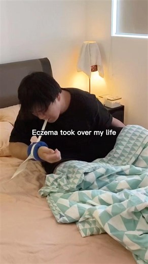 don't let eczema take over your life ❤️‍🩹 #eczema #eczemamitten #fyp #eczemarelief #scratching