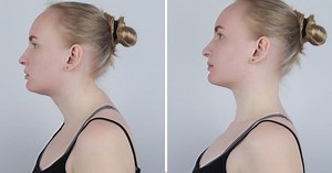 Adieu la bosse de bison : voici 5 exercices quotidiens simples et très efficaces