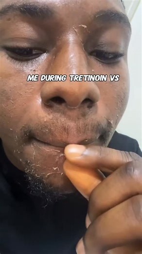 emm_skinsolutions on Instagram