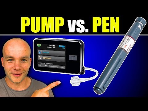 Watch This Before Switching to Insulin Pump from Multiple Daily Injections (MDI)