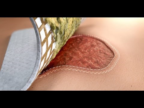 URGOCLEAN AG Mode of Action : the only silver dressing with COMPLETE & CONTINUOUS CLEANING ACTION