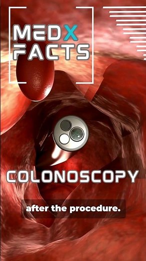 Colonoscopy procedure explained #colon #health