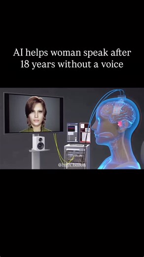 Gustavo | Elite Mindset on Instagram: "Scientists in the United States are developing a breakthrough brain-computer interface that can give speech back to people who have lost their voice due to paralysis, stroke, or ALS. Research teams at leading institutions such as Stanford Medicine, UC Davis Health, UC Berkeley, and UCSF have already tested this technology on real patients. The system works by implanting tiny electrodes in the part of the brain that controls speech. When a person attempts to
