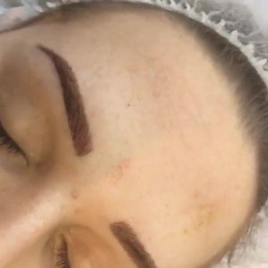 A little video of some Brows I have created with Semi Permanent Makeup. I create a Soft and Fluffy effect using my unique tattooing technique. Creating Micro Hair Strokes using the latest Nano Needle and Soft Shading in the middles to create Depth Semi Permanent Brows can be as natural and light or as dark and bold as you wish Free consultations available Based In Leeds Please inbox for more details **My only Saturday appointments left before Christmas - 19th November 1pm 3pm 17th December 12pm 