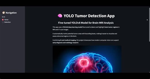 YOLOTumorDetection: AI for Brain Tumor Detection with YOLOv8 | Rawan Alwadeya posted on the topic | LinkedIn