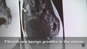 2.3K views · 58 reactions | A newer, more effective treatment for...