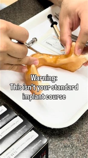 Full Srch, TRI Implants, Same-Day AOX #dentalimplants #sprintray #dentalcourses