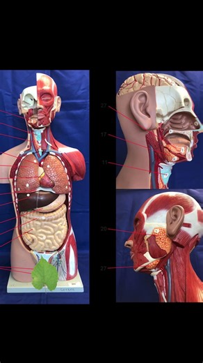 How does an MRI work?