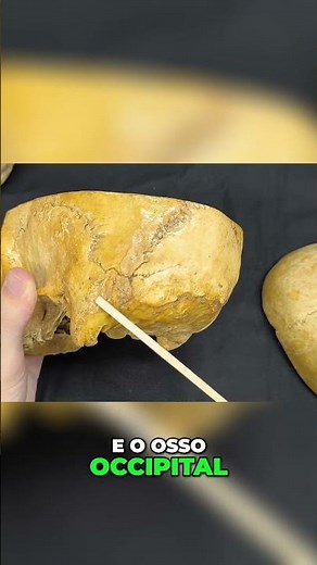 Anatomy of the Skull