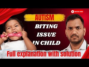 Biting Issue in Children? Understanding Why Children Bite & How to Respond