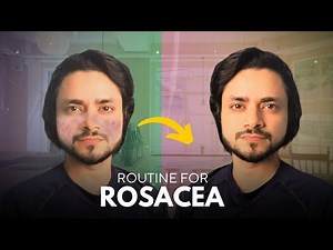 Rosacea Skincare 101: My Morning & Night Routine for Calm Skin