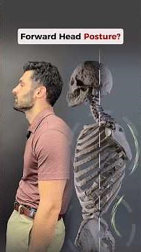 Forward Head Posture? Try This Three Step Process To Fix It! #neckpain #posture #headaches #tmj