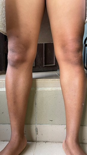 23K views · 163 reactions | Early morning exercise #reelsviralシfb #fypシ #exercisetips | KrisNation | Facebook