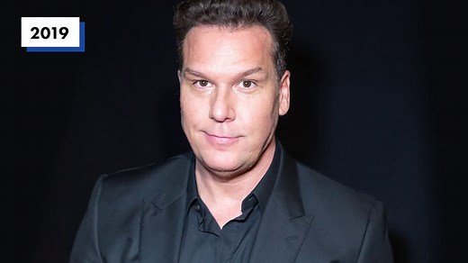 What happened to Dane Cook’s face?