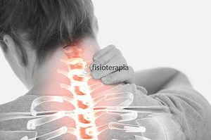 ¿Cómo es el manejo fisioterapéutico de las fracturas cervicales?
