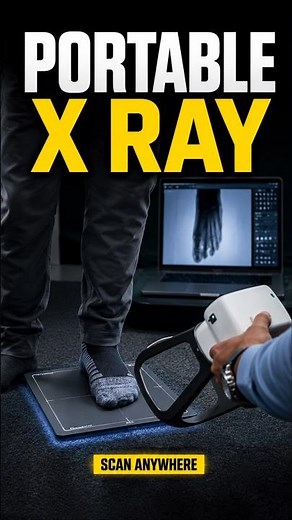 This Portable X Ray Scanner Could Bring Instant Imaging Almost Anywhere #medtech #innovation