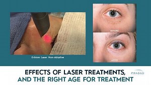 Part 1 Effects of Facial Laser Treatments, and the Right Age for Laser Treatment