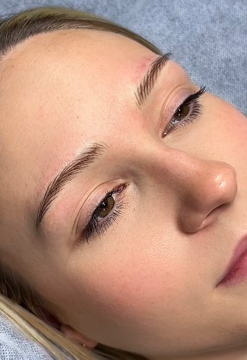 Transforming Thin Brows into Full Beauty