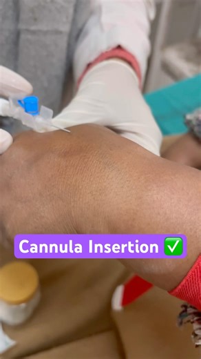Cannula Insertion ✅#nurse #nursing #bscnursing #nursingstudent #ytshorts #mbbs #youtubeshorts #gnm