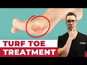 Turf Toe Injury Best Treatments And Recovery Tips [Causes, Symptoms, Grades]