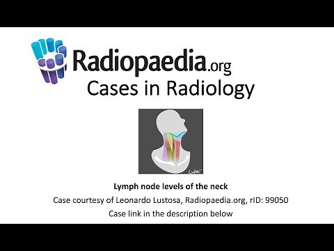 Lymph node levels of the neck (Radiopaedia.org) Cases in Radiology