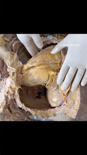 #Dissection of Thoracic Cavity!Dead Teaches Living #medical #medicalstudent #trending #viral