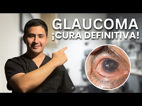 This is how glaucoma surgery (TRABECULECTOMY) works, explained easily!