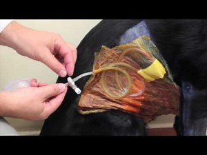 Closed suction drain care (Blake Drain)