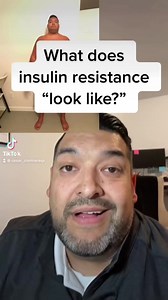 What insulin resistance really looks like even when glucose and A1c are normal. #insulinresistance #glucose #prediabetes #type2diabetes | Reversing insulin resistance