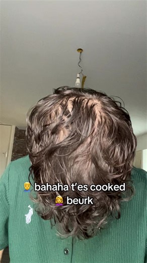 mon avant-après de 3 mois, et les résultats sont déjà encourageants. Toi aussi tu veux retrouver tes cheveux ? commente PROTOCOLE et je vais t’aider. #hairlosstreatment #hair #cheveux #calvitie #minoxidil