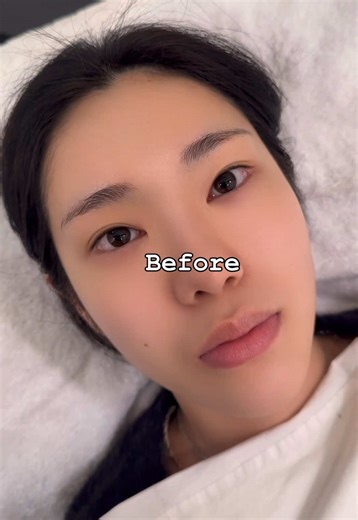 디자인볼륨🤍 연장 오랜만에 하시는 울 고객님! 포인트 있는 디자인연장을 하고싶은데 길이가 너무 긴건 부담스럽다구 하셔서! ☑️ 포인트길이 길지않게 짧게 10,11로 디자인 볼륨이지만 볼륨도 과하지않게! ☑️ 너무 많은 볼륨보다 적당한 볼륨으로 예쁜 시술 해드렸답니당 :) 길이 짧아도 넘 예쁘죵?🩷🍀 . . #속눈썹연장 #수아이래쉬 #홍대속눈썹연장 #koreaeyelash #animelashes